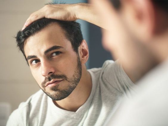 Will the result of hair transplant be permanent?