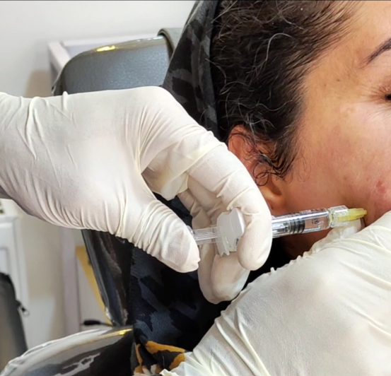 Parvaij mesogel injection in Parsamehr: magic for skin rejuvenation