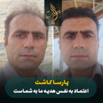 کاشت مو