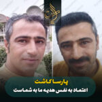 کاشت مو
