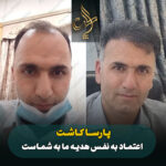 کاشت مو