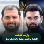کاشت مو
