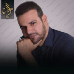 کاشت مو