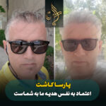 کاشت مو