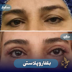کلینیک پوست مو و زیبایی پارسامهر شیراز