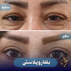 کلینیک پوست مو و زیبایی پارسامهر شیراز