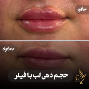 کلینیک پوست مو و زیبایی پارسامهر شیراز