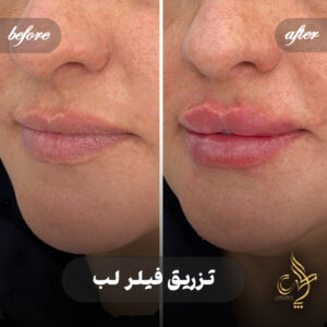 کلینیک پوست مو و زیبایی پارسامهر شیراز