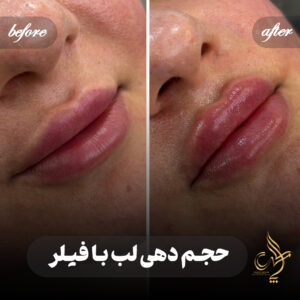 کلینیک پوست مو و زیبایی پارسامهر شیراز