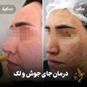 کلینیک پوست مو و زیبایی پارسامهر شیراز