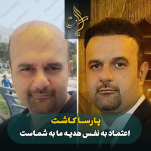نمونه کار کاشت مو شیراز کلینیک پارسامهر