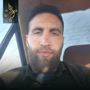 نمونه کار کاشت مو شیراز کلینیک پارسامهر