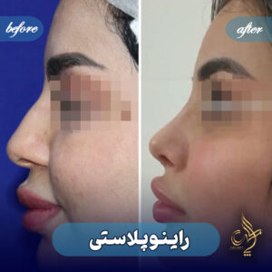کلینیک پوست مو و زیبایی پارسامهر شیراز