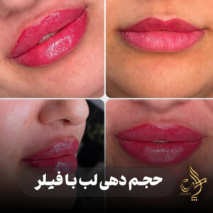 کلینیک پوست مو و زیبایی پارسامهر شیراز
