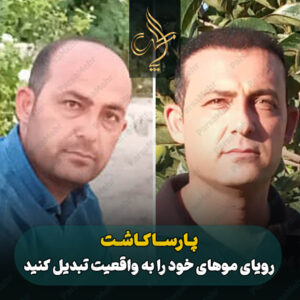 نمونه کار کاشت مو شیراز کلینیک پارسامهر