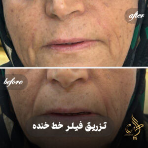 کلینیک پوست مو و زیبایی پارسامهر شیراز