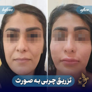 کلینیک پوست مو و زیبایی پارسامهر شیراز