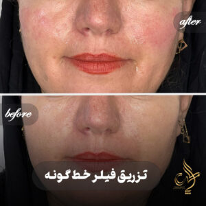 کلینیک پوست مو و زیبایی پارسامهر شیراز