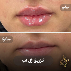 کلینیک پوست مو و زیبایی پارسامهر شیراز