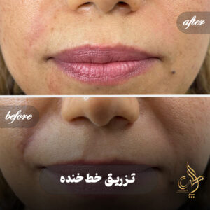 کلینیک پوست مو و زیبایی پارسامهر شیراز