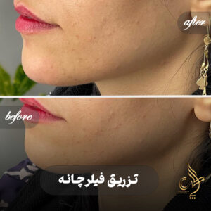 کلینیک پوست مو و زیبایی پارسامهر شیراز