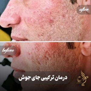 کلینیک پوست مو و زیبایی پارسامهر شیراز
