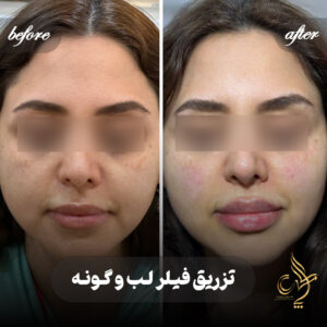 کلینیک پوست مو و زیبایی پارسامهر شیراز