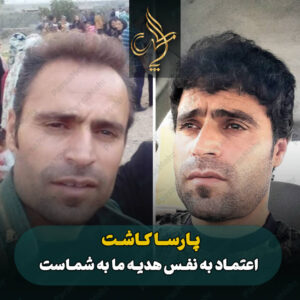 نمونه کار کاشت مو شیراز کلینیک پارسامهر