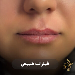 کلینیک پوست مو و زیبایی پارسامهر شیراز