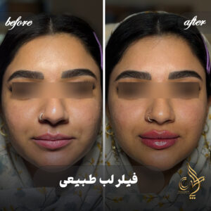کلینیک پوست مو و زیبایی پارسامهر شیراز