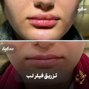 کلینیک پوست مو و زیبایی پارسامهر شیراز