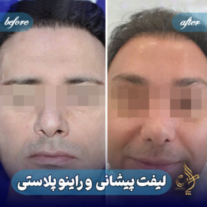 کلینیک پوست مو و زیبایی پارسامهر شیراز