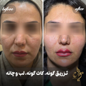 کلینیک پوست مو و زیبایی پارسامهر شیراز