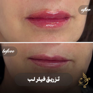 کلینیک پوست مو و زیبایی پارسامهر شیراز