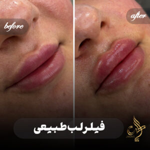 کلینیک پوست مو و زیبایی پارسامهر شیراز