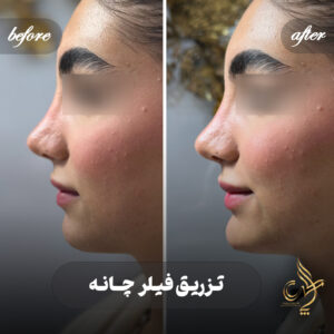 کلینیک پوست مو و زیبایی پارسامهر شیراز
