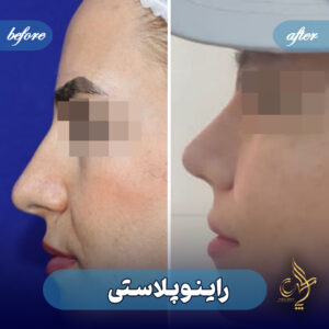 کلینیک پوست مو و زیبایی پارسامهر شیراز