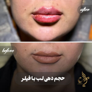 کلینیک پوست مو و زیبایی پارسامهر شیراز