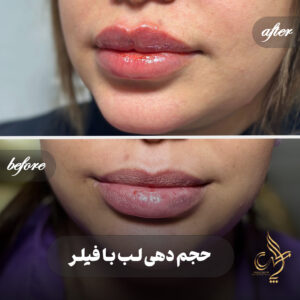 کلینیک پوست مو و زیبایی پارسامهر شیراز