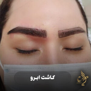 کلینیک پوست مو و زیبایی پارسامهر شیراز