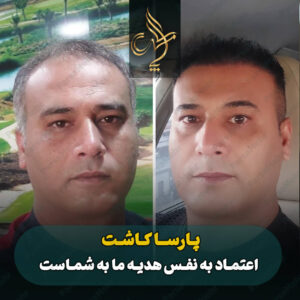 نمونه کار کاشت مو شیراز کلینیک پارسامهر
