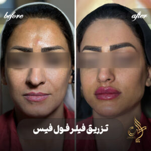 کلینیک پوست مو و زیبایی پارسامهر شیراز