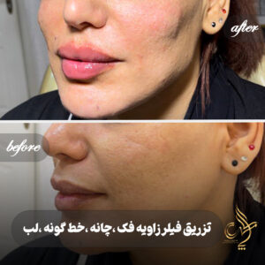 کلینیک پوست مو و زیبایی پارسامهر شیراز