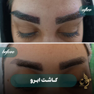 کلینیک پوست مو و زیبایی پارسامهر شیراز