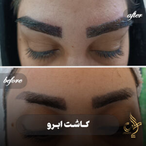 کلینیک پوست مو و زیبایی پارسامهر شیراز