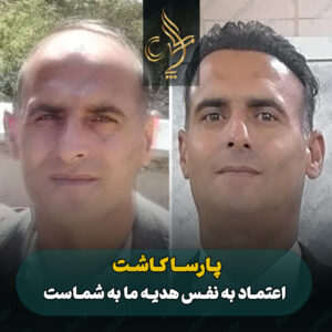 نمونه کار کاشت مو شیراز کلینیک پارسامهر