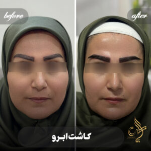 کلینیک پوست مو و زیبایی پارسامهر شیراز