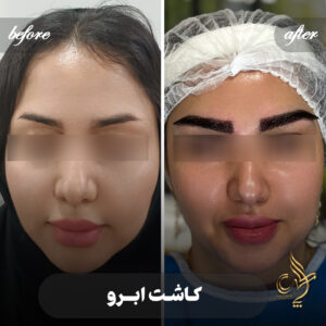 کلینیک پوست مو و زیبایی پارسامهر شیراز