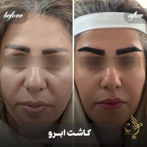 کلینیک پوست مو و زیبایی پارسامهر شیراز