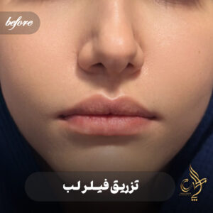 کلینیک پوست مو و زیبایی پارسامهر شیراز